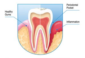 Teeth Detail Graph