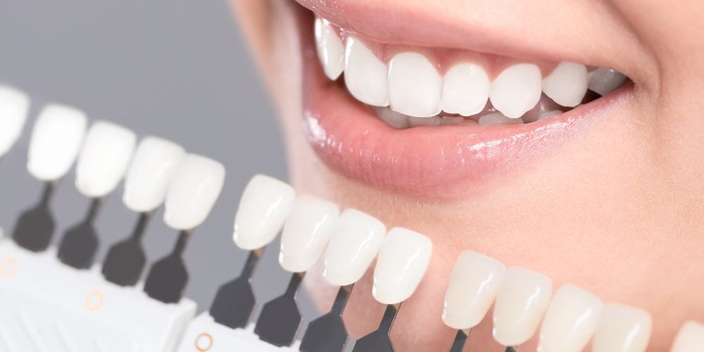 Best Cosmetic Dentist in Delhi - SouthEx Dental